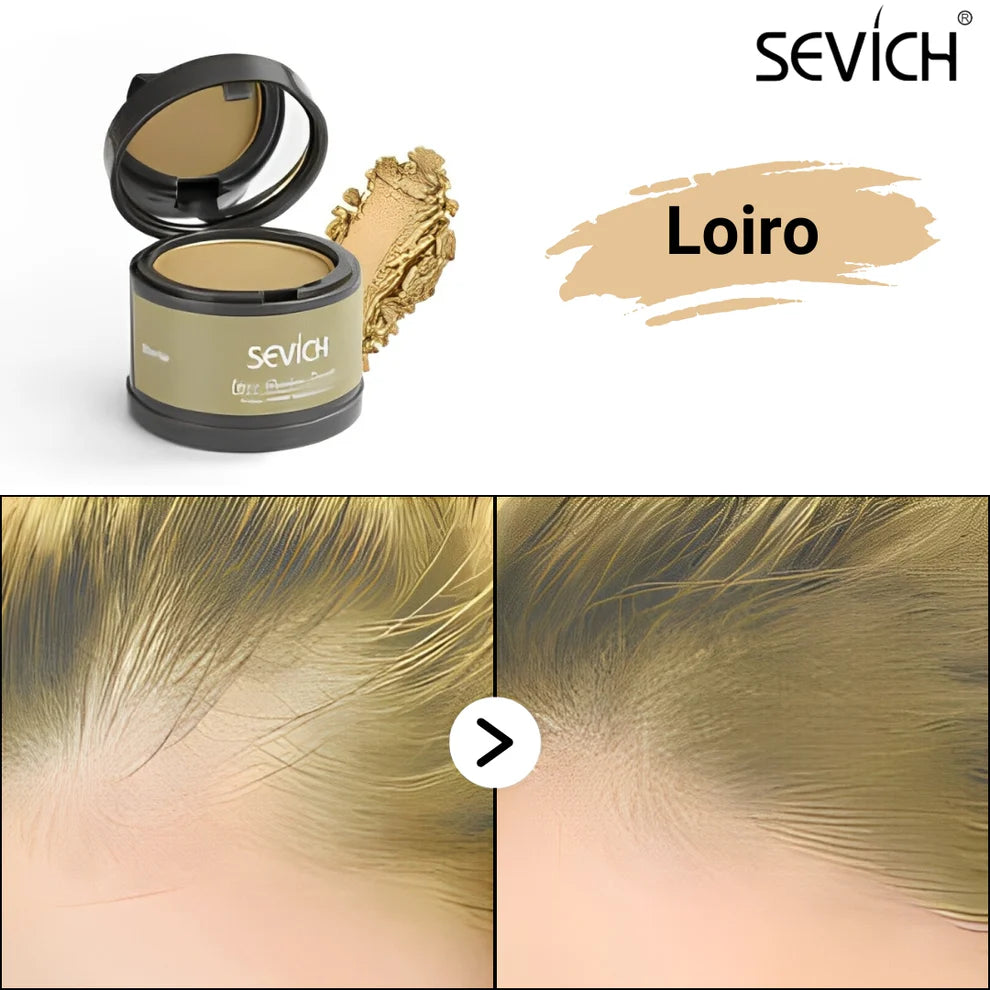 SEVÍCH ProFix