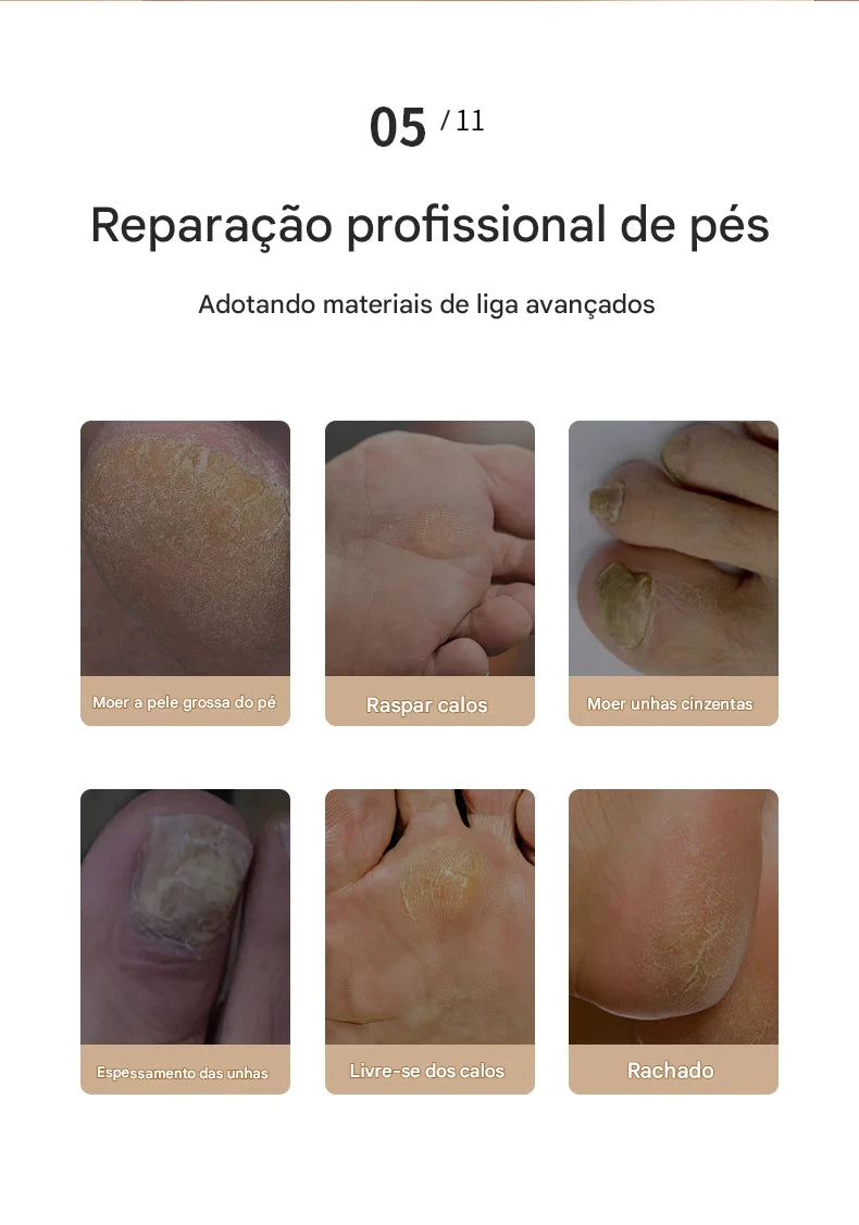 FRESA REMOVE CALOS E CALOSIDADES PARA PÉS PERFEITOS SEM RACHADURAS