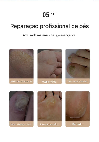 FRESA REMOVE CALOS E CALOSIDADES PARA PÉS PERFEITOS SEM RACHADURAS