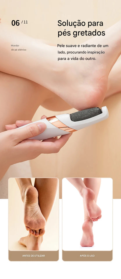 FRESA REMOVE CALOS E CALOSIDADES PARA PÉS PERFEITOS SEM RACHADURAS