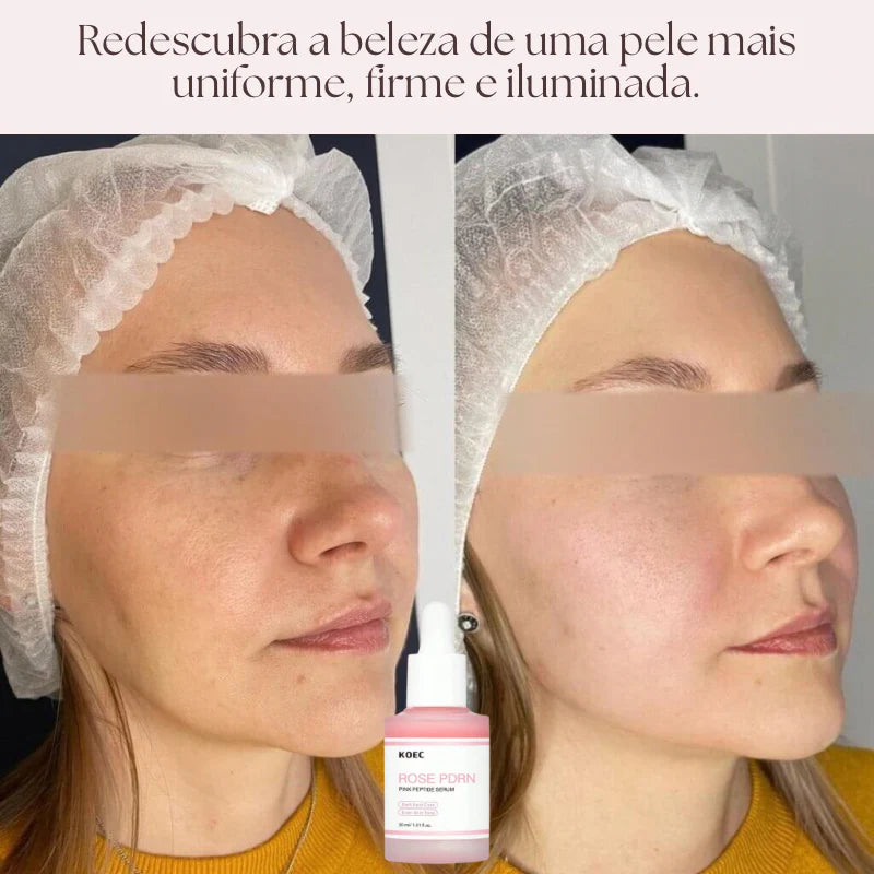 Tecnologia Coreana Sérum PDRN Regenerador da Pele DNA de Salmão