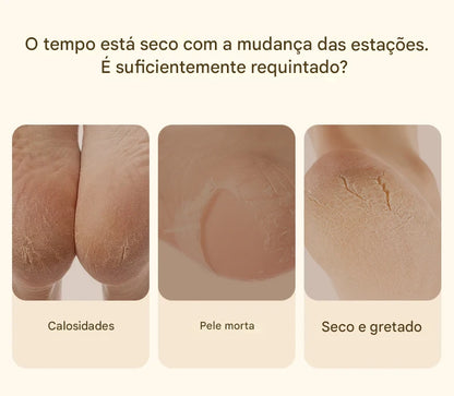 FRESA REMOVE CALOS E CALOSIDADES PARA PÉS PERFEITOS SEM RACHADURAS