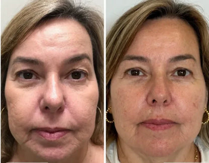 Collagen Fit™ – Máscara Lifting de Colagénio com Efeito Pele de Vidro
