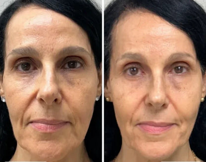 Collagen Fit™ – Máscara Lifting de Colagénio com Efeito Pele de Vidro