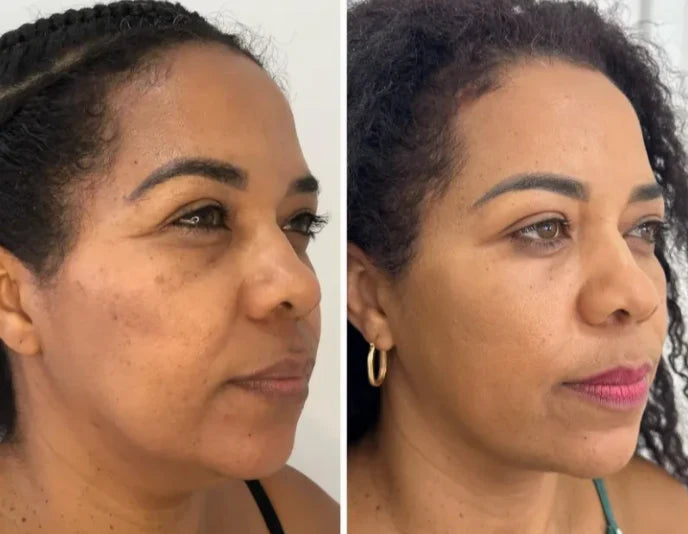 Collagen Fit™ – Máscara Lifting de Colagénio com Efeito Pele de Vidro