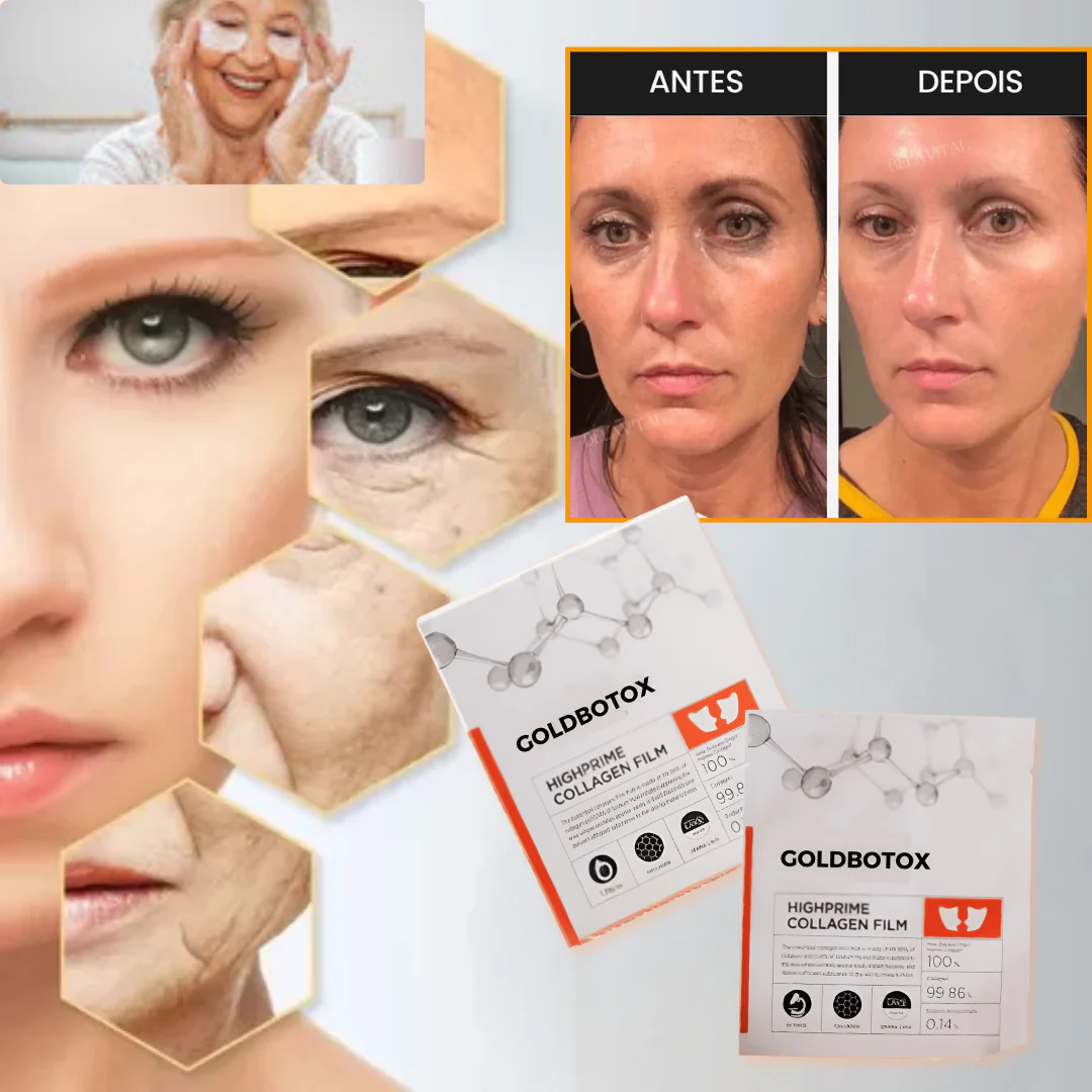 GOLDBOTOX - Anti-Envelhecimento