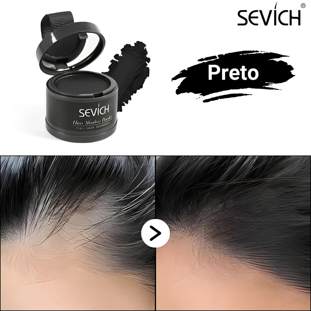 SEVÍCH ProFix