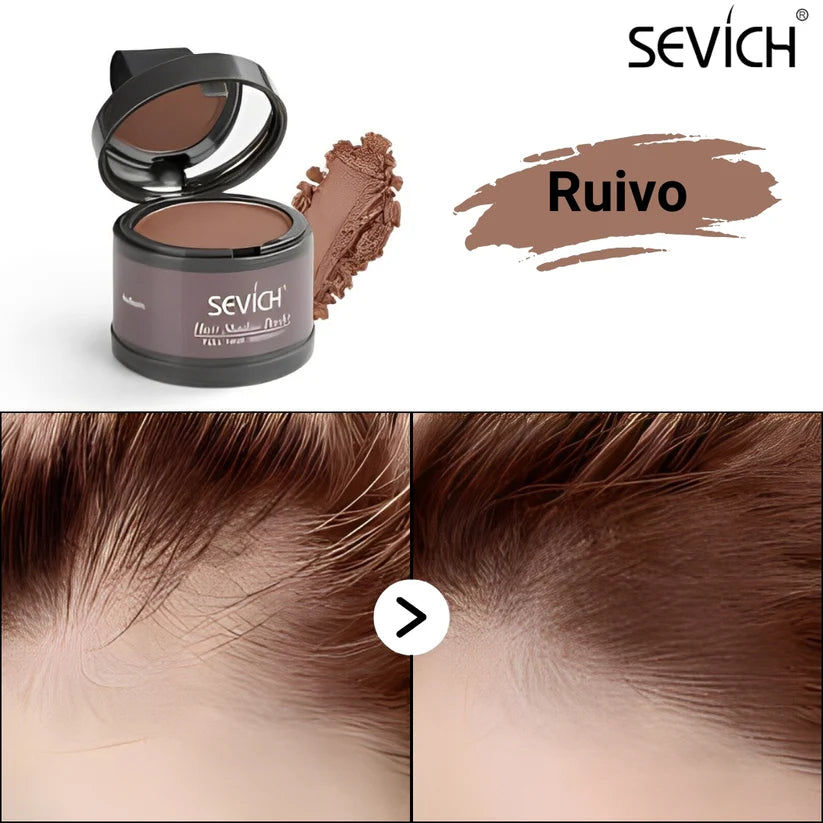 SEVÍCH ProFix