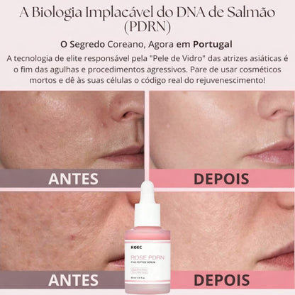 Tecnologia Coreana Sérum PDRN Regenerador da Pele DNA de Salmão