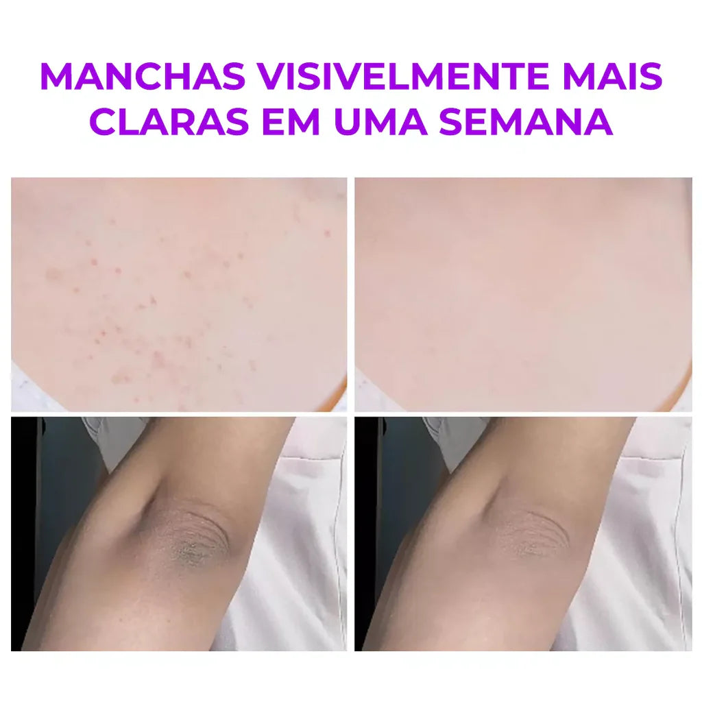 Melashot™ Perfect Skin – Pele Clara e Iluminada em Minutos!