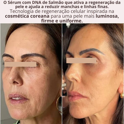 Tecnologia Coreana Sérum PDRN Regenerador da Pele DNA de Salmão