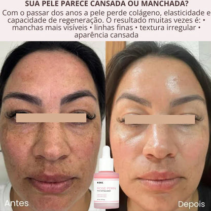 Tecnologia Coreana Sérum PDRN Regenerador da Pele DNA de Salmão