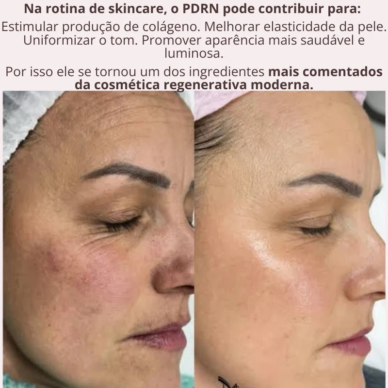 Tecnologia Coreana Sérum PDRN Regenerador da Pele DNA de Salmão